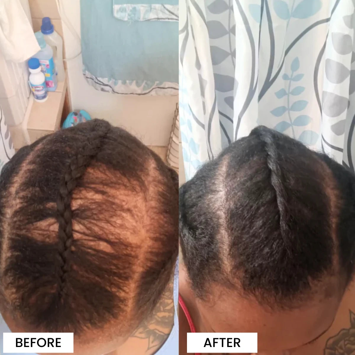 3-in-1 Rosemary + Batana + Fenugreek Hair Growth Oil™