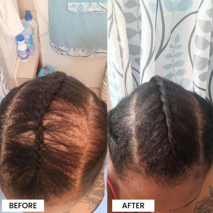 3-in-1 Rosemary + Batana + Fenugreek Hair Growth Oil™
