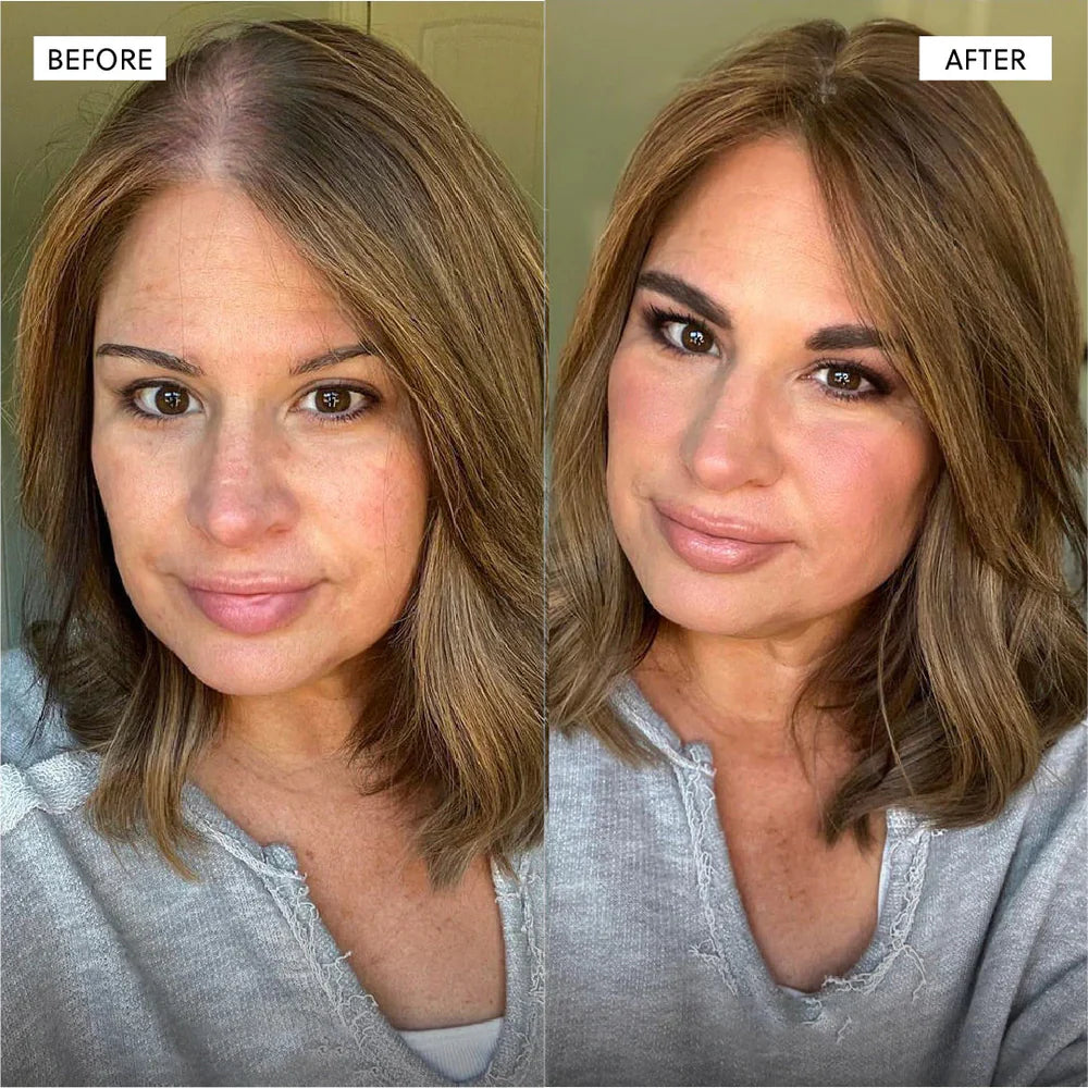 3-in-1 Rosemary + Batana + Fenugreek Hair Growth Oil™