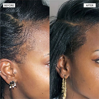 3-in-1 Rosemary + Batana + Fenugreek Hair Growth Oil™